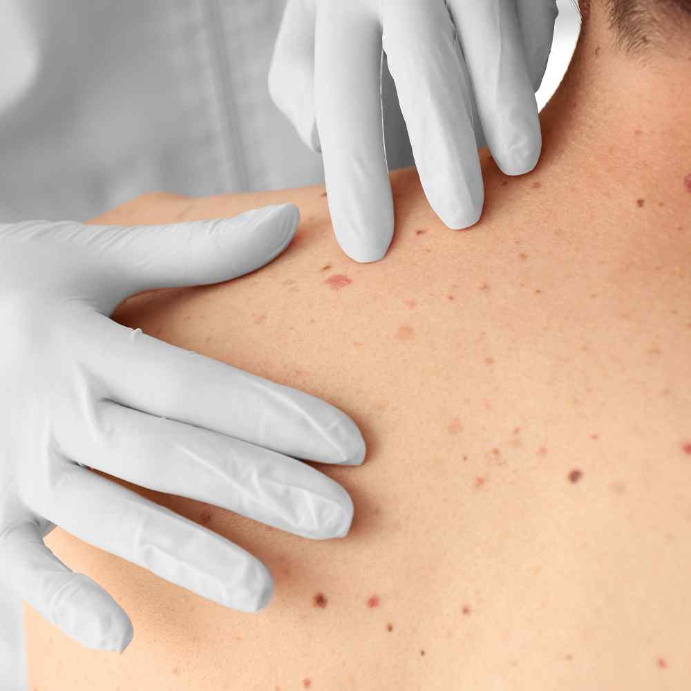 https://medicalparkinternational.net/aesthetic/wp-content/uploads/2022/08/price_plan_01.jpg